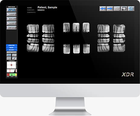 screenshot of XDR Dental Imaging